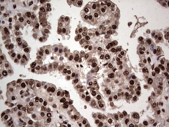 SAE1 Antibody in Immunohistochemistry (Paraffin) (IHC (P))