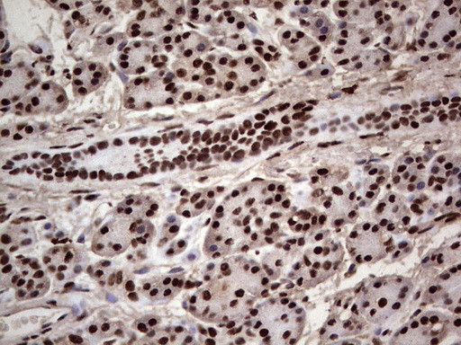 SAE1 Antibody in Immunohistochemistry (Paraffin) (IHC (P))