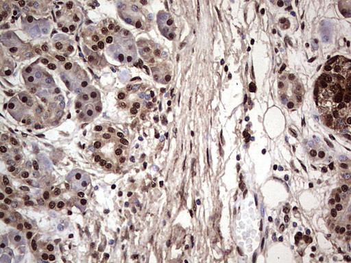 SAE1 Antibody in Immunohistochemistry (Paraffin) (IHC (P))