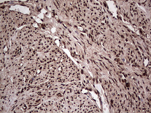 SAE1 Antibody in Immunohistochemistry (Paraffin) (IHC (P))