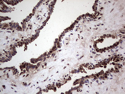 SAE1 Antibody in Immunohistochemistry (Paraffin) (IHC (P))