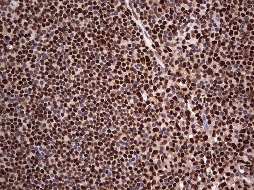 SAE1 Antibody in Immunohistochemistry (Paraffin) (IHC (P))