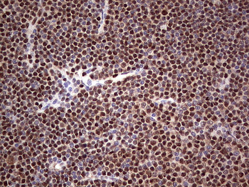 SAE1 Antibody in Immunohistochemistry (Paraffin) (IHC (P))