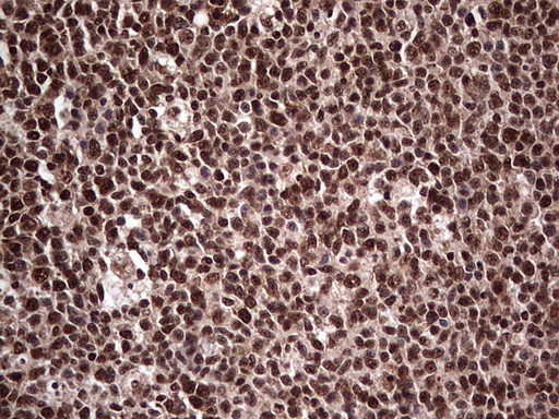 SAE1 Antibody in Immunohistochemistry (Paraffin) (IHC (P))