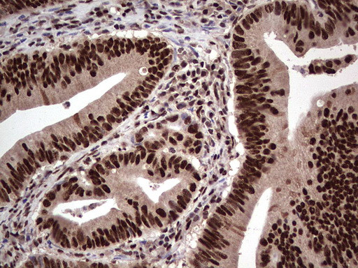 SAE1 Antibody in Immunohistochemistry (Paraffin) (IHC (P))