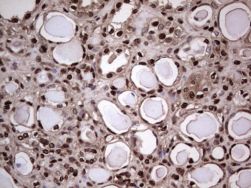 SAE1 Antibody in Immunohistochemistry (Paraffin) (IHC (P))