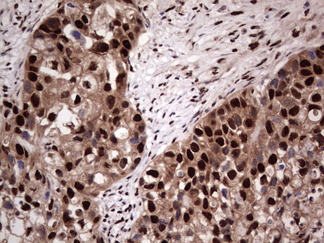 SAE1 Antibody in Immunohistochemistry (Paraffin) (IHC (P))