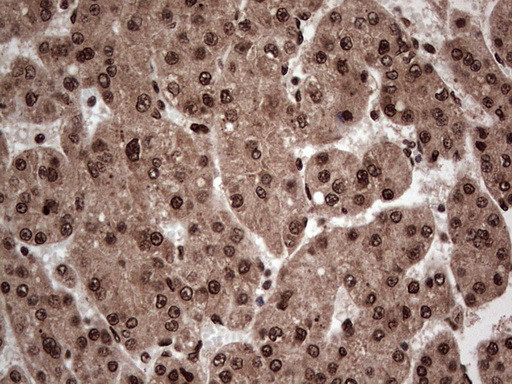 SAE1 Antibody in Immunohistochemistry (Paraffin) (IHC (P))