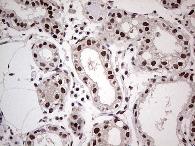 SAE1 Antibody in Immunohistochemistry (Paraffin) (IHC (P))