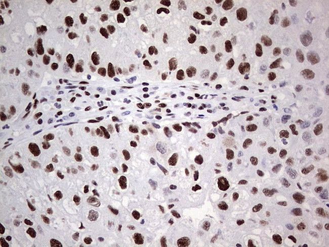 SAE1 Antibody in Immunohistochemistry (Paraffin) (IHC (P))