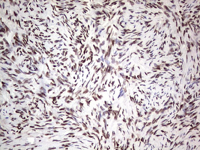 SAE1 Antibody in Immunohistochemistry (Paraffin) (IHC (P))