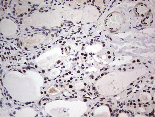 SAE1 Antibody in Immunohistochemistry (Paraffin) (IHC (P))