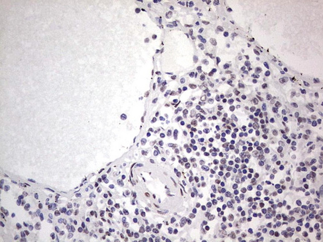 SAE1 Antibody in Immunohistochemistry (Paraffin) (IHC (P))