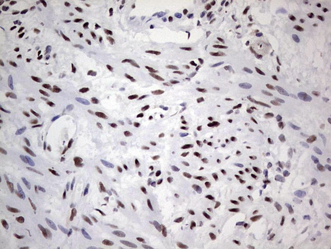 SAE1 Antibody in Immunohistochemistry (Paraffin) (IHC (P))