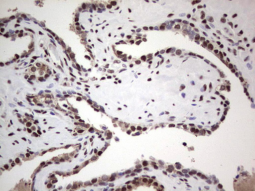 SAE1 Antibody in Immunohistochemistry (Paraffin) (IHC (P))