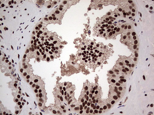 SAE1 Antibody in Immunohistochemistry (Paraffin) (IHC (P))