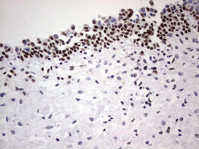 SAE1 Antibody in Immunohistochemistry (Paraffin) (IHC (P))