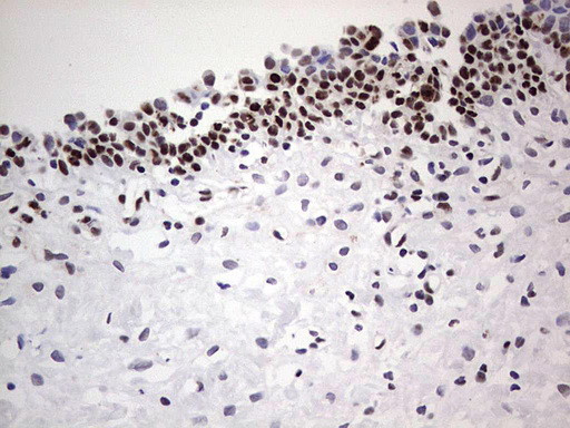 SAE1 Antibody in Immunohistochemistry (Paraffin) (IHC (P))