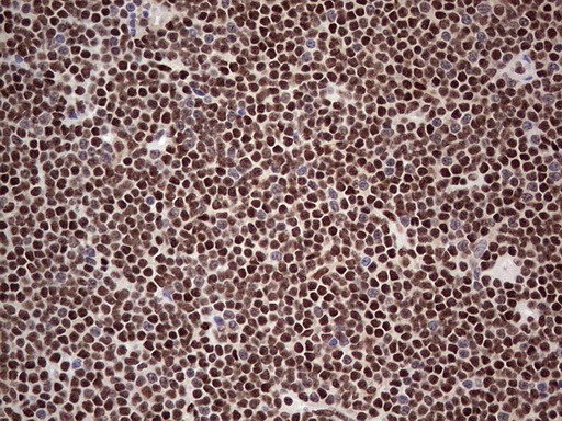 SAE1 Antibody in Immunohistochemistry (Paraffin) (IHC (P))