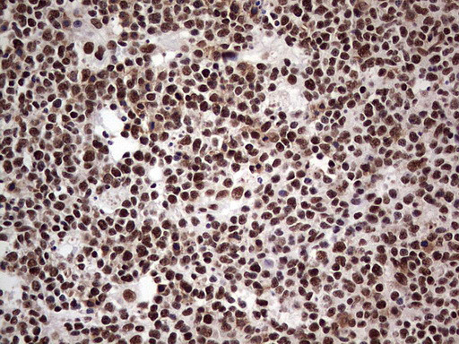 SAE1 Antibody in Immunohistochemistry (Paraffin) (IHC (P))