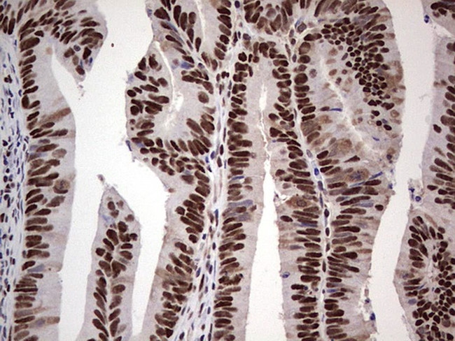 SAE1 Antibody in Immunohistochemistry (Paraffin) (IHC (P))