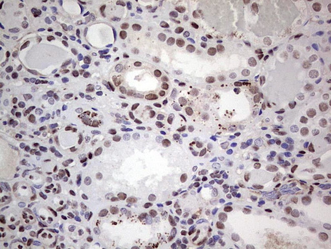 SAE1 Antibody in Immunohistochemistry (Paraffin) (IHC (P))