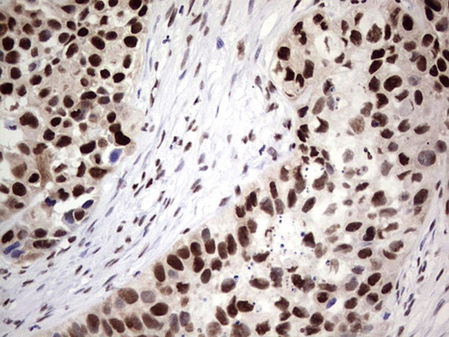 SAE1 Antibody in Immunohistochemistry (Paraffin) (IHC (P))