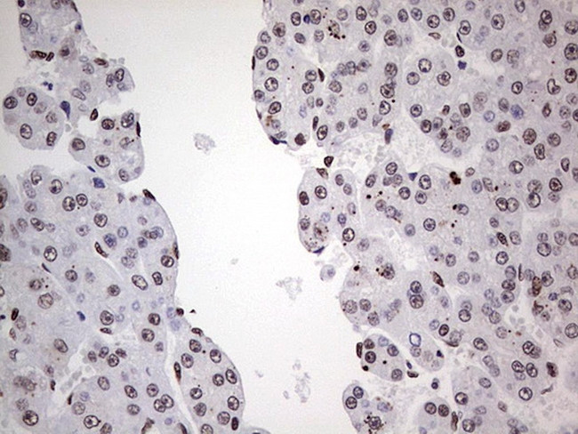 SAE1 Antibody in Immunohistochemistry (Paraffin) (IHC (P))