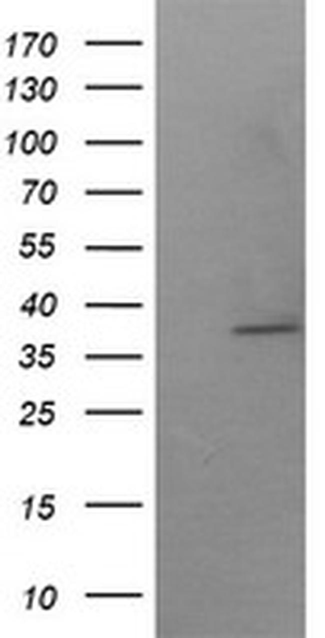 SAE1 Antibody in Western Blot (WB)