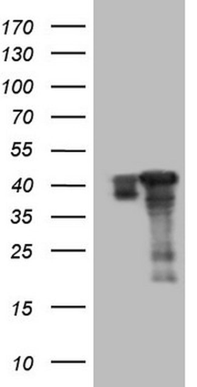 SAE1 Antibody in Western Blot (WB)