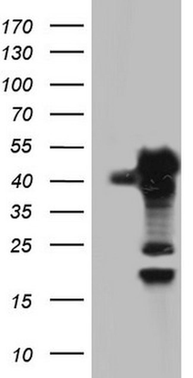 SAE1 Antibody in Western Blot (WB)