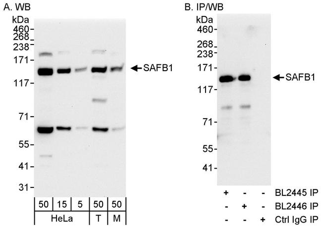 SAFB1 Antibody in Western Blot (WB)