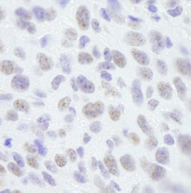 SAFB1 Antibody in Immunohistochemistry (IHC)