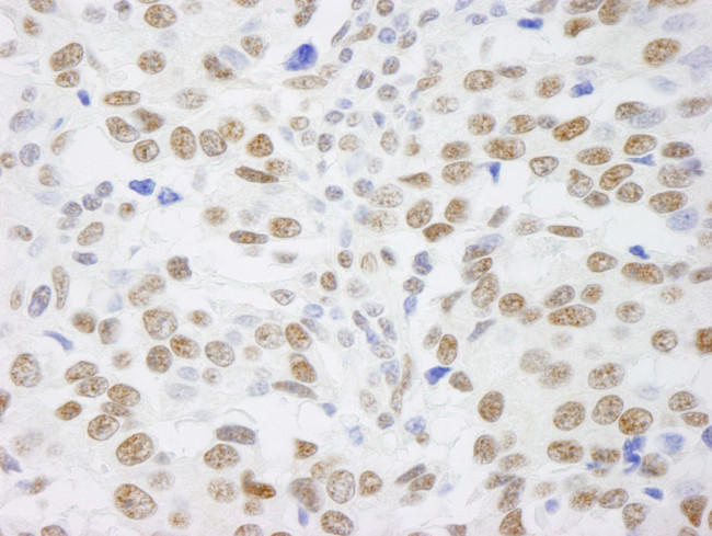 SAFB1 Antibody in Immunohistochemistry (IHC)