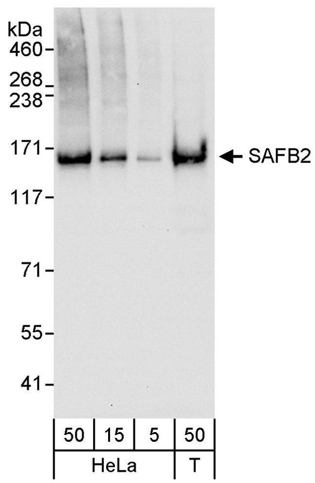 SAFB2 Antibody in Western Blot (WB)