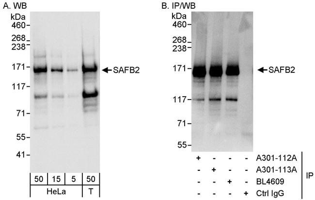 SAFB2 Antibody in Western Blot (WB)