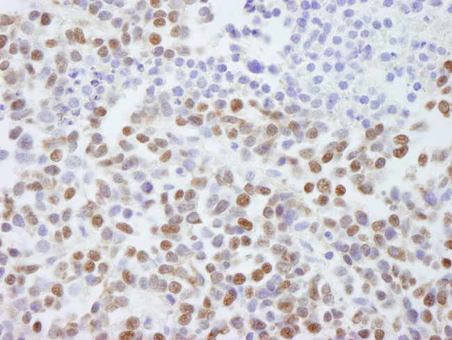 SAFB2 Antibody in Immunohistochemistry (IHC)