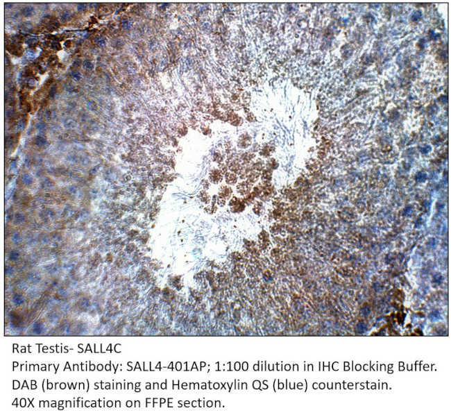 SALL4C Antibody in Immunohistochemistry (IHC)