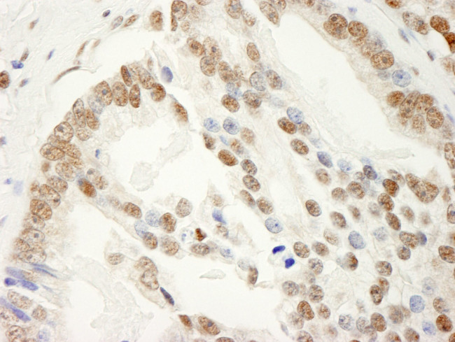 SAM68 Antibody in Immunohistochemistry (IHC)