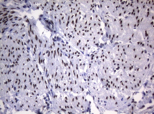 SAMD12 Antibody in Immunohistochemistry (Paraffin) (IHC (P))