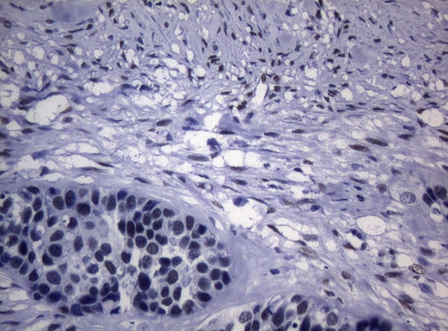 SAMD12 Antibody in Immunohistochemistry (Paraffin) (IHC (P))