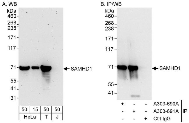 SAMHD1 Antibody in Western Blot (WB)