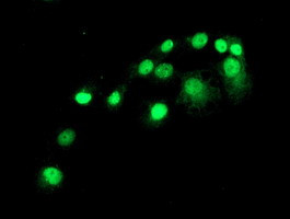 SAMHD1 Antibody in Immunocytochemistry (ICC/IF)