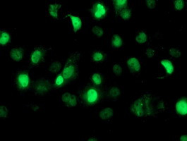 SAMHD1 Antibody in Immunocytochemistry (ICC/IF)