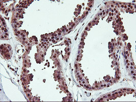 SAMHD1 Antibody in Immunohistochemistry (Paraffin) (IHC (P))