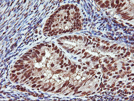 SAMHD1 Antibody in Immunohistochemistry (Paraffin) (IHC (P))