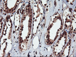 SAMHD1 Antibody in Immunohistochemistry (Paraffin) (IHC (P))