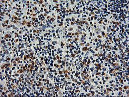 SAMHD1 Antibody in Immunohistochemistry (Paraffin) (IHC (P))