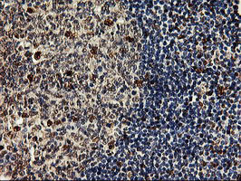 SAMHD1 Antibody in Immunohistochemistry (Paraffin) (IHC (P))