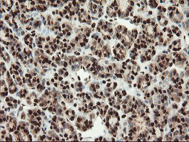 SAMHD1 Antibody in Immunohistochemistry (Paraffin) (IHC (P))